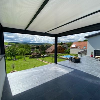 Pergola anthracite à Nancy